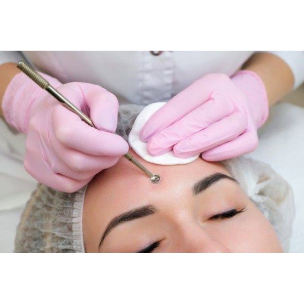 Механічна чистка обличчя